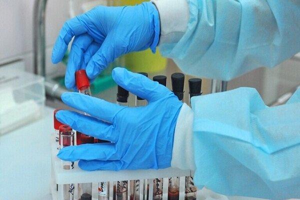 نتایج طرح بیماریابی کرونا، آمار بستری ها از غربالگری 7.5میلیون نتایج طرح بیماریابی کرونا، آمار بستری ها از غربالگری 7.5میلیون نفر
