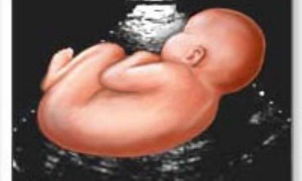 این لحظه های تکرار نشدنی! این لحظه های تکرار نشدنی!